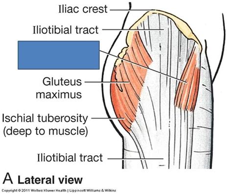 Anatomy Block Iii Gluteal Region Thigh Lumbosacral Plexus Flashcards