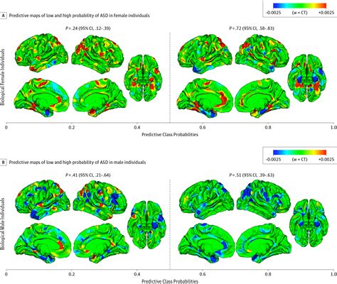 Association Of Autism Spectrum Disorder With Sex Related Phenotypic Diversity In Brain Structure