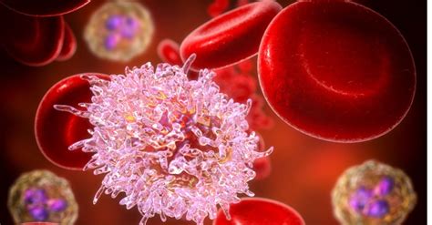 Blood Cancer Symptoms Causes Diagnosis Types And Treatment Options