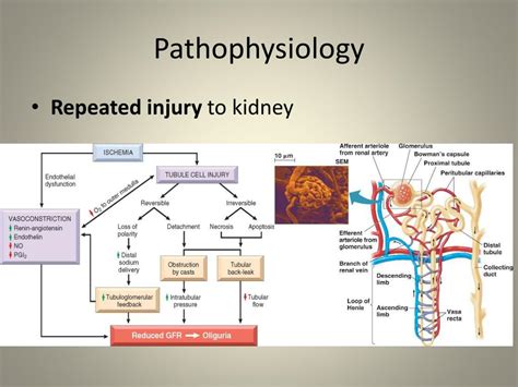 Pathophysiology Pathogenesis Of Chronic Kidney Disease Gambaran