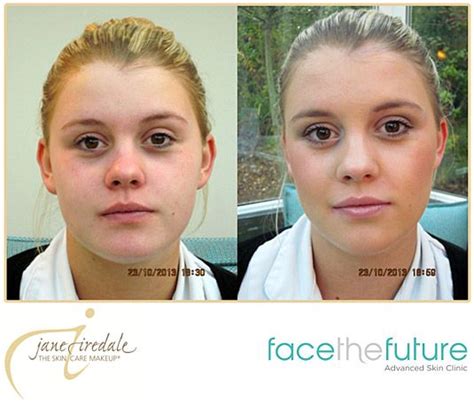 Beautiful Before And After With Jane Iredale The Mineral Makeup Skin