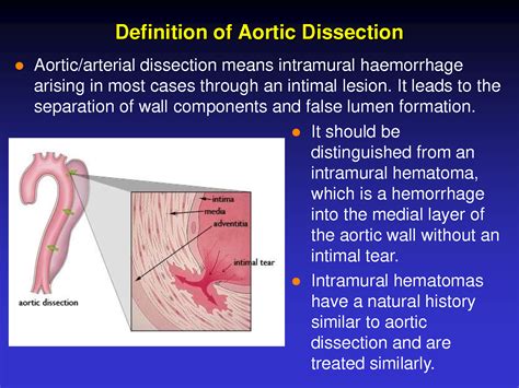 Solution Definition Of Aortic Dissection Presentation Studypool