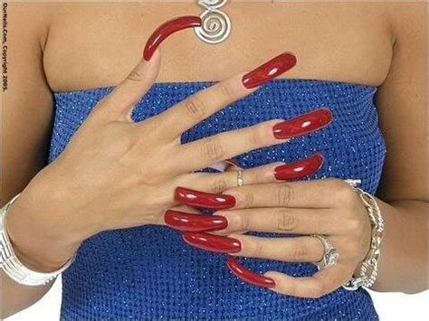 Why do orthodontists use rubber bands with braces? Pin on Nails