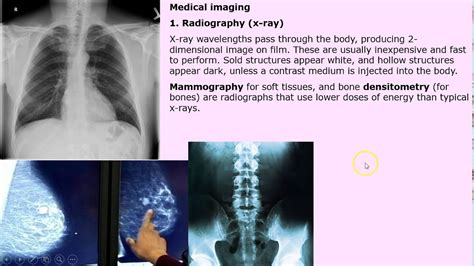 X Rays Mris And Other Medical Imaging Methods Youtube