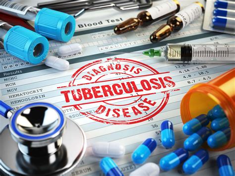 Active Tuberculosis Can Be Sniffed Out From Tb Like Diseases In Just 30