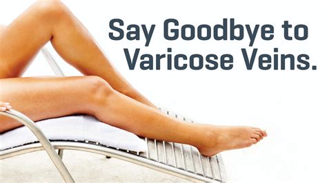 Varicose Veins Treatments And Cost Noah Spode