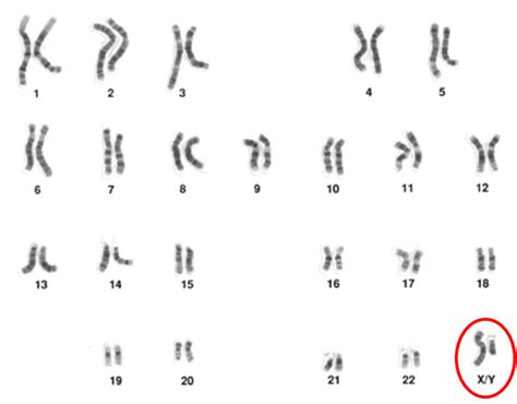Where did these chromosomes come from? Let Them Eat Kait: The amazing X chromosome