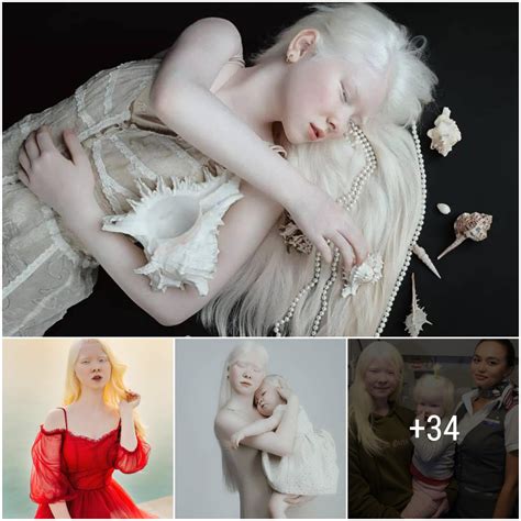 Rare And Beautiful Photos Of Sisters With Albinism Were Revealed Shaking The Global Modeling