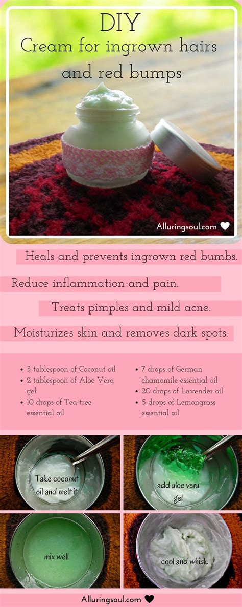Honey helps keep the skin moisturized, soft and smooth. Ingrown Hair Home Remedies | Spefashion