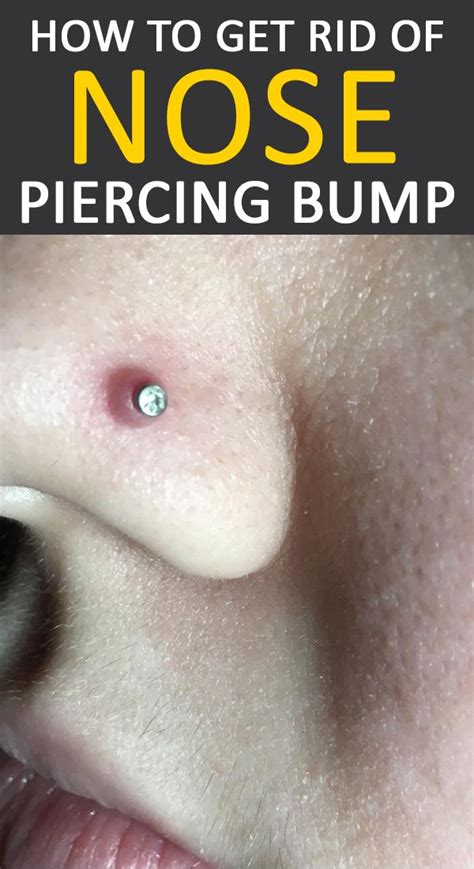 How To Get Rid Of Nose Piercing Bump Piercing Bump Nose Piercing Bump Nose Piercing