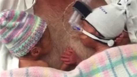 Video Of Preemie Twins Holding Hands In Australia Is Shared Tens Of Thousands Of Times Ktla