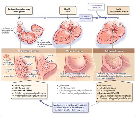 The Developmental Origin Of Calcific Aortic Stenosis Nejm