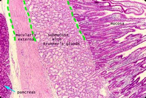 Duodenum Histology Slide With Labeled Diagram Anatomylearner The My