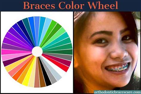 Interactive Braces Color Wheel