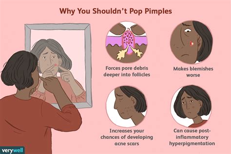 Popped Pimple