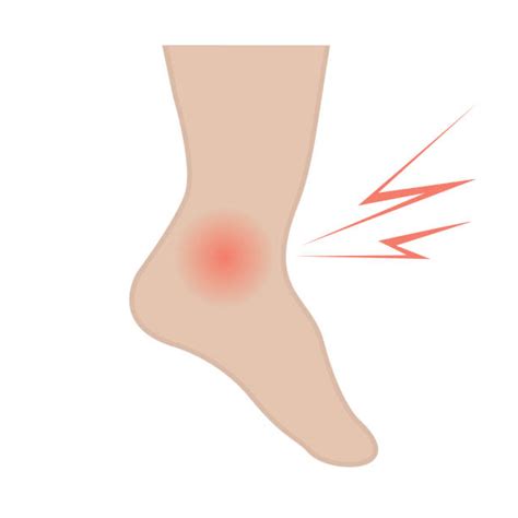 Cartoon Of The Ankle Sprain Illustrations Royalty Free Vector Graphics