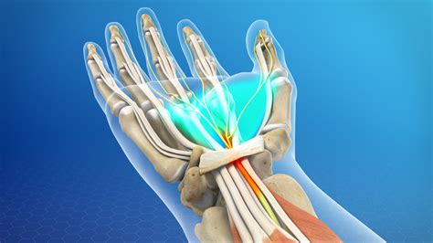 Carpal Tunnel Syndrome Effective Therapy Treatments Pars Health Clinic