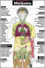 Pictures of Long Term Effects Of Marijuana On The Body