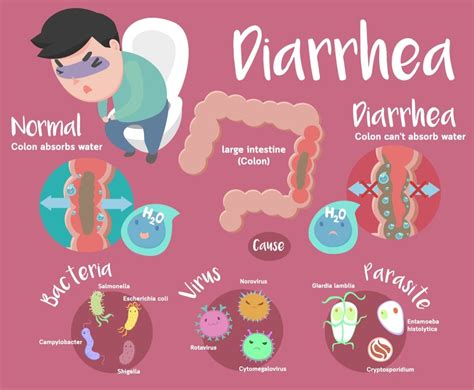 Diarrhea Cause Symptoms And Treatments Diarrhea Causes Symptoms My