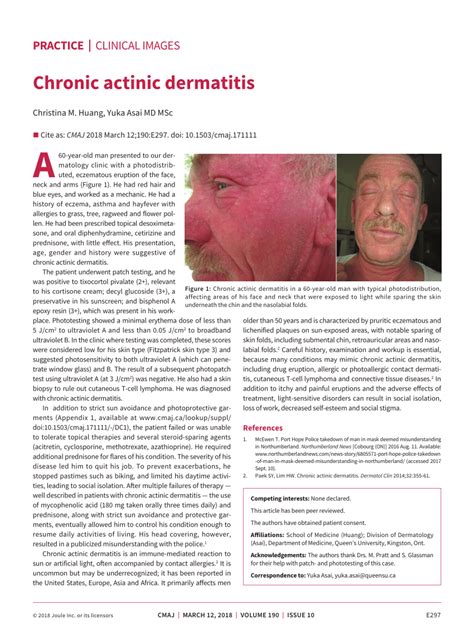 Pdf Chronic Actinic Dermatitis