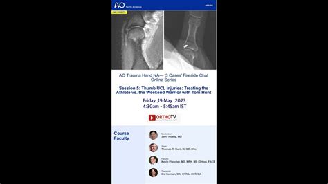 AO Trauma Hand NA- Thumb UCL Injuries: Treating the Athlete vs. the