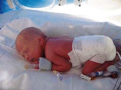 Miracle Baby Grace Was Born Prematurely At 29 Weeks Kildare Live