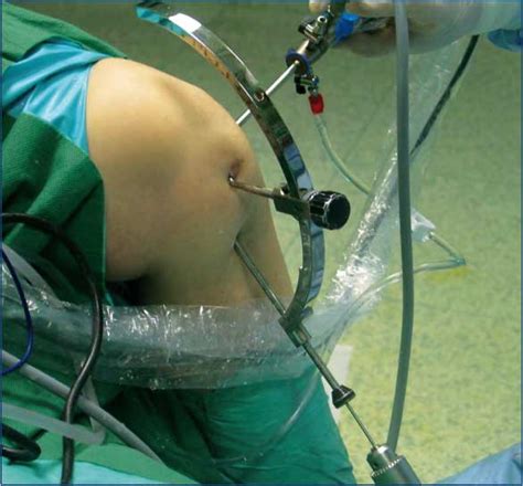 Il Medico sportivo 2011 °°