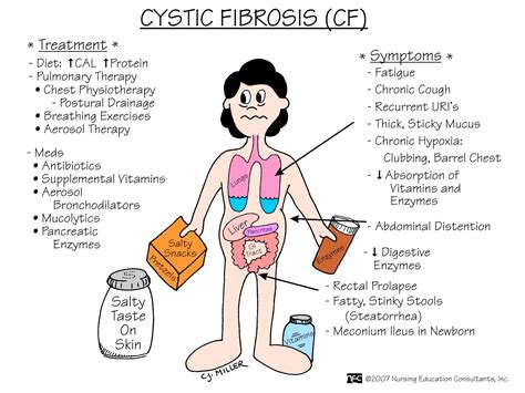 Cystic Fibrosis Cf Onestopnursing