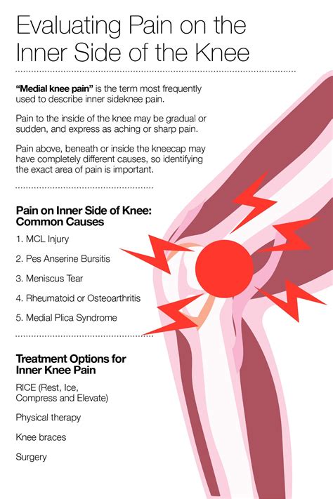 Knee Pain Area Chart