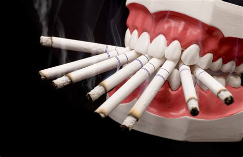 How Does Smoking Affect Your Gums Part 1 | Intelligent Dental