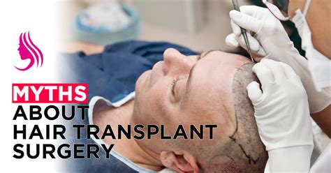 Common Myths About Hair Transplant Surgery RS Skin And Hair Clinic