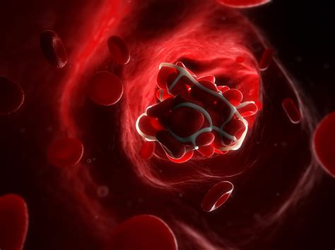 Covid 19 Survivors Increased Risk Of Blood Clots May Stem From