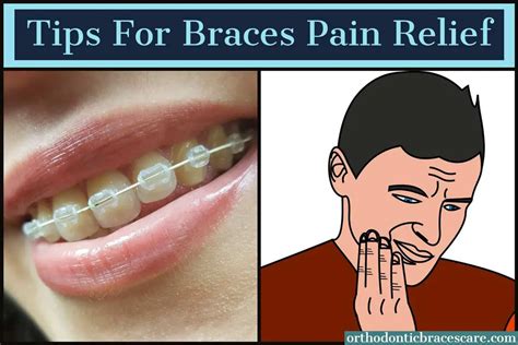 How To Relieve Pain From Braces 25 Tips Orthodontic Braces Care