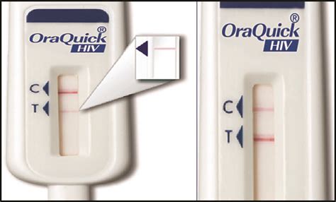 Oral Fluid Test Aids Concern
