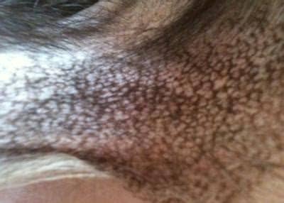 Hair that grows from the armpits. Red dots under dog's armpit area with black scaly looking ...