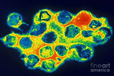Tem Of Rubella German Measles Photograph By Scott Camazinecdc Fine