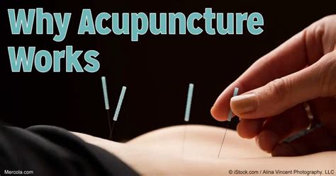 Acupuncture Why It Works Wake Up World