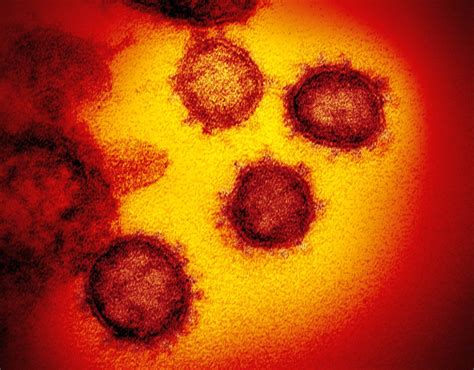 The delta coronavirus variant doubles the risk of hospitalisation compared with the previously dominant variant in britain, but two doses of vaccine still provide strong protection, a scottish study. Pfizer produces less antibodies against Delta variant ...