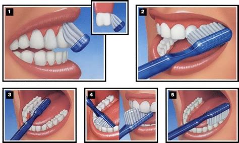Proper Tooth Brushing And Flossing Techniques Patient Education