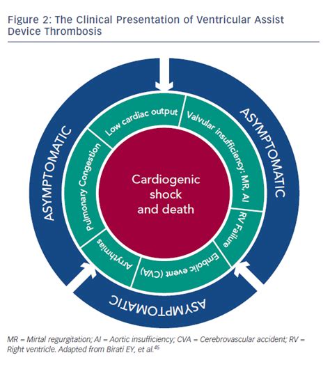 Figure 2 The Clinical Presentation Of Ventricular Assist Device