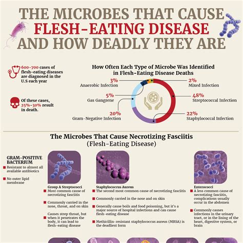 The Microbes That Cause Flesh Eating Disease And How Deadly They Are