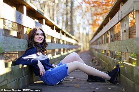 Inspirational Model Tessa Snyder Who Had Leg Amputated At 11 Encourages Others To Be Proud Of