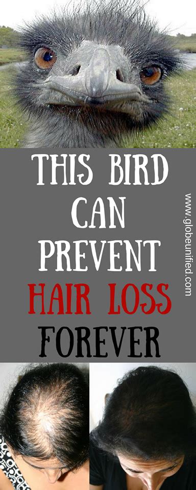 It works best when your scalp is not yet completely damaged. How to Make Your Hair Thicker? Vitamins For Growing ...