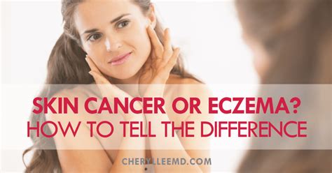 Skin Cancer Or Breast Cancer How To Tell The Difference