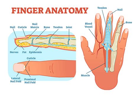 The arrows point toward the tumor. Finger Anatomy Medical Vector Illustration With Bones ...