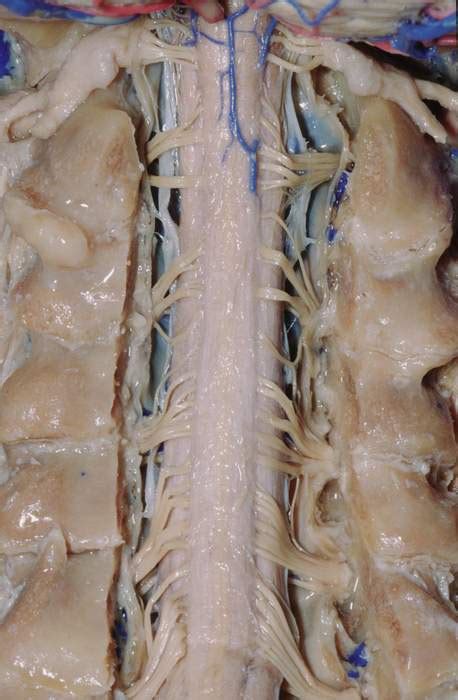 Posterior View of Cervical Spinal Cord In Situ | Neuroanatomy | The
