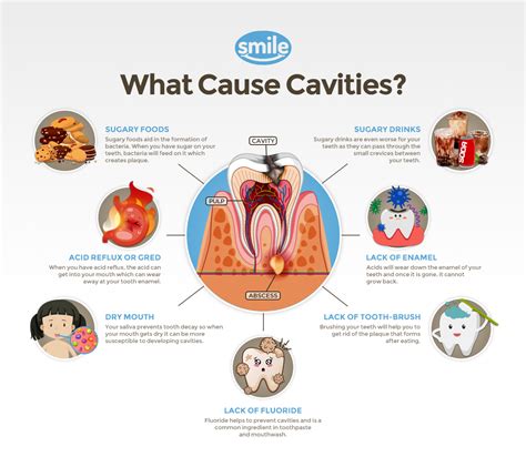 Pediatric Dentistry | What are the causes of cavities