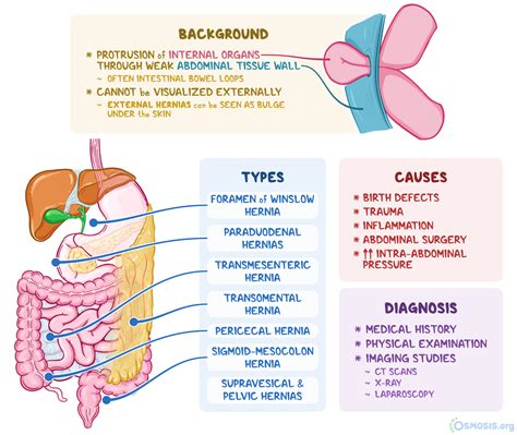 Hernias Of The Abdomen