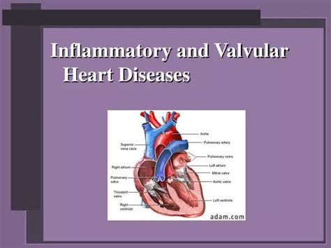 Ppt Inflammatory And Valvular Heart Diseases Powerpoint Presentation