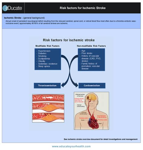 Risk Factors For Ischemic Stroke Qr Educate Health